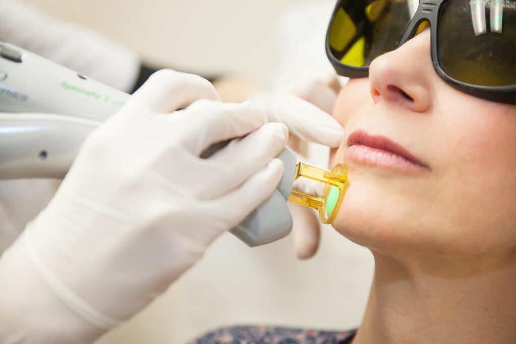 لیزر موهای زائد