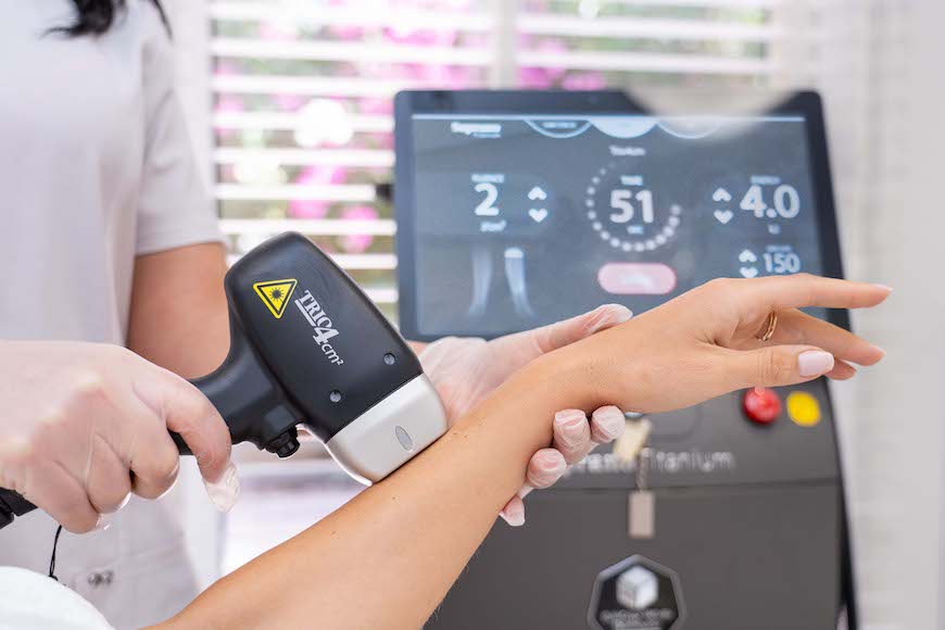 دستگاه لیزر موهای زائد سوپرانو